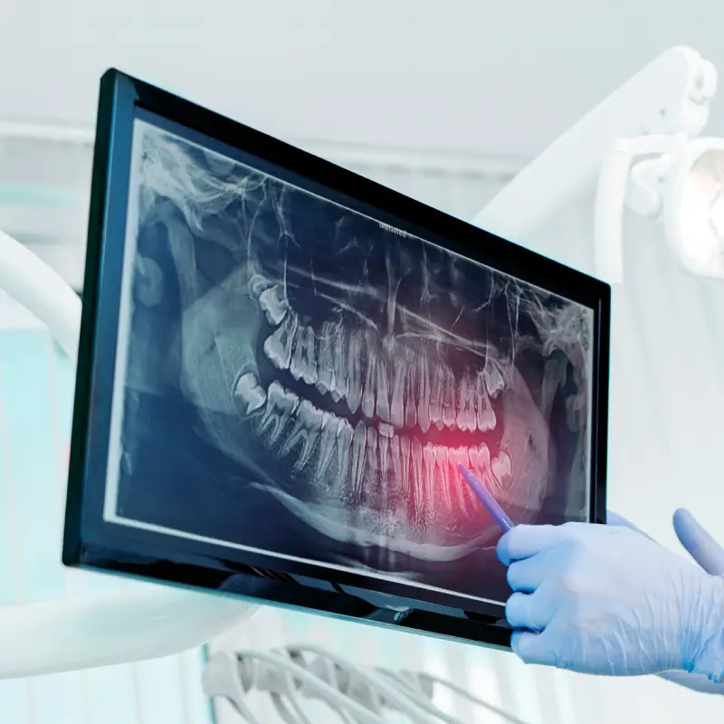 Radiología Bucal y Maxilofacial