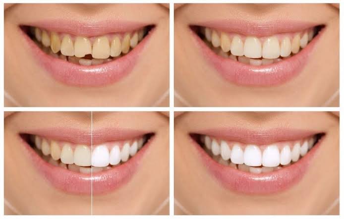 Odontología Restauradora y Estética